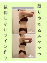 メゾンワン(maison one)/差がつくのは背中と二の腕