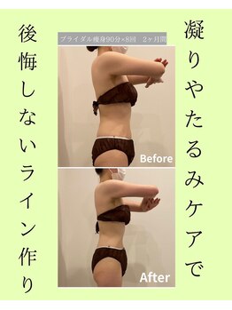 メゾンワン(maison one)/差がつくのは背中と二の腕