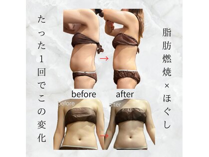 サンナナヨンプラス(374+)の写真