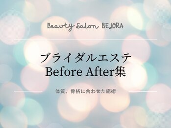 ビジョーラ 銀座本店(BEJORA)/ブライダルエステBefore After集