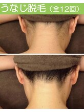 キックアス(KICK ASS)/うなじ脱毛 うなじ美人 夏