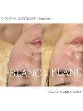 サロン ド ブラン アオヤマ(Salon de BLANC AOYAMA)/イラストリアス90分コース