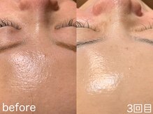 ハレオラ(HaleOla)/元々お綺麗な方はさらに綺麗に！