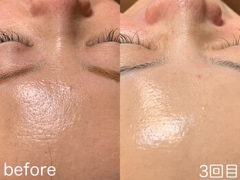 ハレオラ(HaleOla)/元々お綺麗な方はさらに綺麗に!