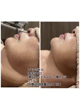 ヴォーグ(Vogue)/レモンボトル/ブライダル/松戸