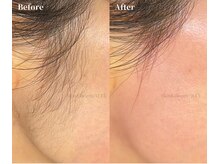 もみあげワックス☆横顔は人に与える印象の8割！明るいお顔に♪