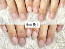 グラシナ 名古屋金山店/(深爪／長さだし/フィルイン)