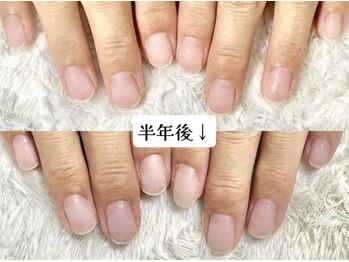 グラシナ 名古屋金山店/(深爪／長さだし/フィルイン)