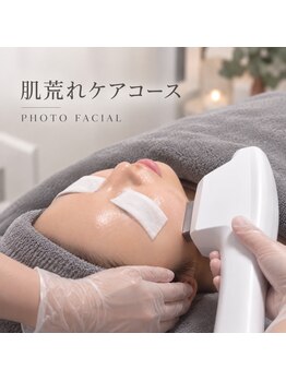 アンヘル(Angel)の写真/毛穴・肌荒れ・年齢肌に☆3つのIPL光フェイシャルで一人ひとりの肌悩みに合わせて理想の素肌へ