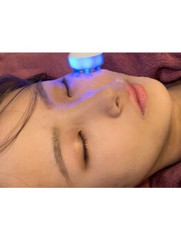 小顔になりたい