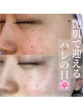 エリス(ELISSE)/艶肌で迎えるハレの日