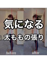 カワル整体 上通り院/太ももの張りが気になる人