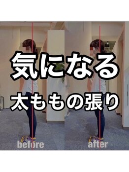 カワル整体 上通り院/太ももの張りが気になる人