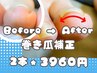 【新メニュー】フット巻爪補正　導入キャンペーン　2本【両足親指】
