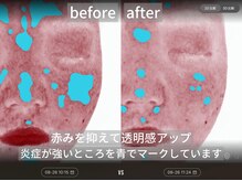 ダイヤモンドトゥルース(Diamond truth)/肌の基礎力をアップ