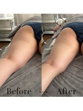 レアリゼ(REALISER)/【shave整体×鬼指ゴリンパ】