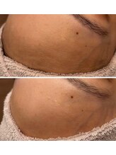 ビュウナ 銀座(BEAUNA)/アルティメットパルス