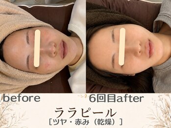 エスポワール(espoir)/before・after