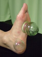 健倖舘(ケンコウカン)/吸い玉コース