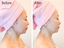 ライトウェーブ 松本村井本店/50代　あご周りが引き締まる！