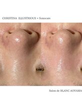 サロン ド ブラン アオヤマ(Salon de BLANC AOYAMA)/イラストリアス90分コース