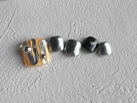 定額フットネイル