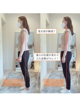 サンテリア(Santelia)/姿勢改善：１度でも変化を実感