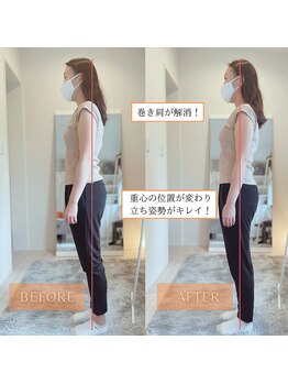 サンテリア(Santelia)/姿勢改善：１度でも変化を実感