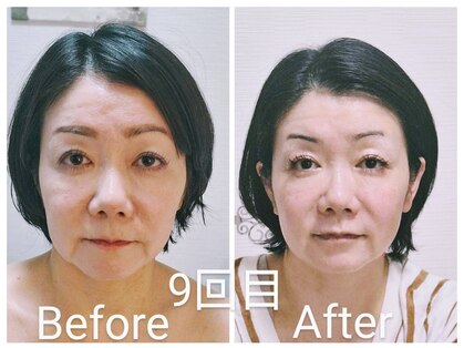 自然美(SHIZENBI)の写真
