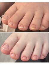 ケアプラス(care plus)/フットネイルケア
