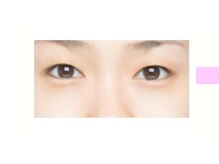 クロム アイプラス 狭山 入曽店(CHROM eye+)/腫れぼったく眠たげなまぶたに！