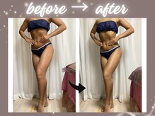 リヘッド(Re.head)の雰囲気（リヘッド公式LINE@390bfwszからお問い合わせも◎痩身/ヘッドスパ）