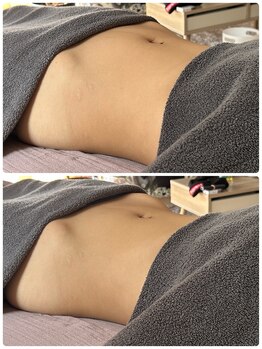 セレン(Seren)の写真/体の歪みスッキリ！ボキボキしない骨盤矯正でポッコリお腹を根本改善♪