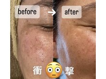 クレール 小山店(CLAIR)/【サーマナイフ+エレポレ】