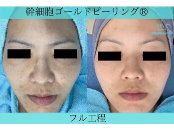 リメイククリニカルビューティー(Remake clinical beauty)/