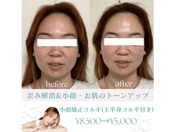 アプリコット(apricot)