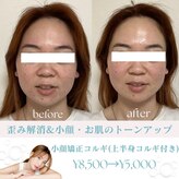 アプリコット(apricot)