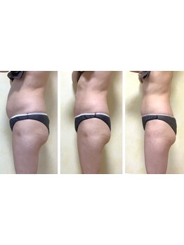 サイズダウンを目指したい