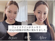 ヨサパーク リリア 立川北口店(YOSA PARK Lylia)/オーナーの変化