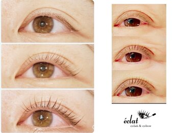 エクラ(eclat)の写真/【まつげのお悩みに寄り添う大人ケア】細さ・ハリ不足・ダメージに配慮し、健やかなまつげケアを大切に◎