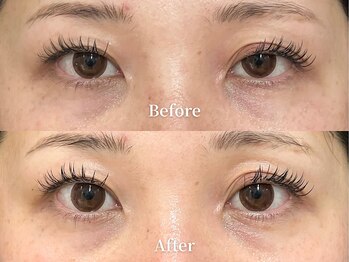 アストリエ グレース 相模大野(Astorie Grace)の写真/【珍しい目元特化型エステ】まぶたの重さ・クマ・眼精疲労をやさしくケア。自然に若々しい目元へ変化！