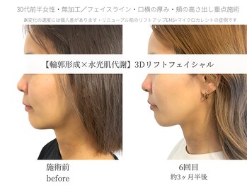 サボラミ(sabor A Mi)/表情筋ケアがたるみを改善します