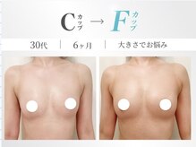 美人バスト 赤羽店の雰囲気（豊胸級バストアップ！3カップUPの実績！卒業後も戻らない育乳！）