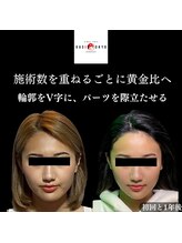 オアシス トウキョウ 川崎店(OASIS TOKYO)/1年継続のお客様