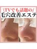毛穴レスへ【毛穴エクストラクションプロ】毛穴改善コース80分¥13000→¥11000