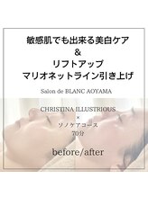 サロン ド ブラン アオヤマ(Salon de BLANC AOYAMA)/クリスティーナイラストリアス