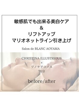 サロン ド ブラン アオヤマ(Salon de BLANC AOYAMA)/クリスティーナイラストリアス