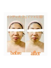 リオラ ビューティー(Liora beauty)/《before/after》