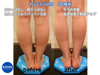 アオハル 東京(AOHAL)/夕方パンパンのむくみ足に救世主