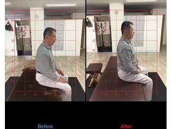 ストレチックス 近江八幡店/BeforeAfter